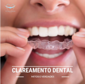 Read more about the article Mitos e verdades sobre clareamento dental